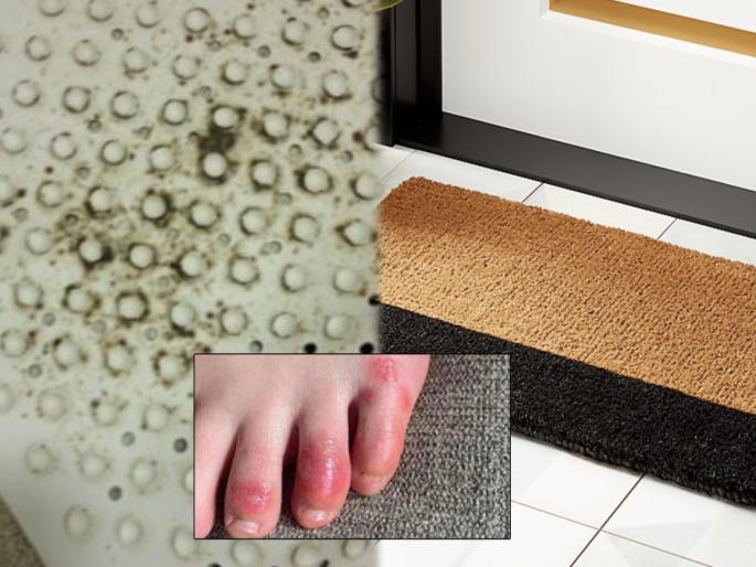 Skin infection preventions : Unhygienic bath mats side effects prevention tips | Skin infection : आजारांचं कारण ठरतेय बाथरूमबाहेरची घाणेरडी पायपुसणी; वाचा तोटे अन् बचावाचे उपाय