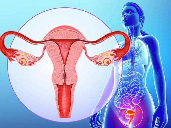 Women's Health : Main reason for the disruption of the reproductive process is PCOS | Women's Health : गर्भधारणेत अडथळा येण्याचं मोठं कारण; तरूण मुलींनी वेळीच लक्ष द्यायला हवं