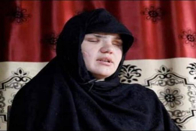 Afghanistan Taliban Crisis taliban kidnapped me shot me in head and took out my eyes says afghan woman | Afghanistan Taliban Crisis : हृदयद्रावक! "तालिबानींनी माझं अपहरण केलं, डोक्यात गोळ्या झाडल्या आणि नंतर काढले डोळे" Afghanistan Taliban Crisis taliban kidnapped me shot me in head and took out my eyes says afghan woman | Afghanistan Taliban Crisis : हृदयद्रावक! "तालिबानींनी माझं अपहरण केलं, डोक्यात गोळ्या झाडल्या आणि नंतर काढले डोळे"