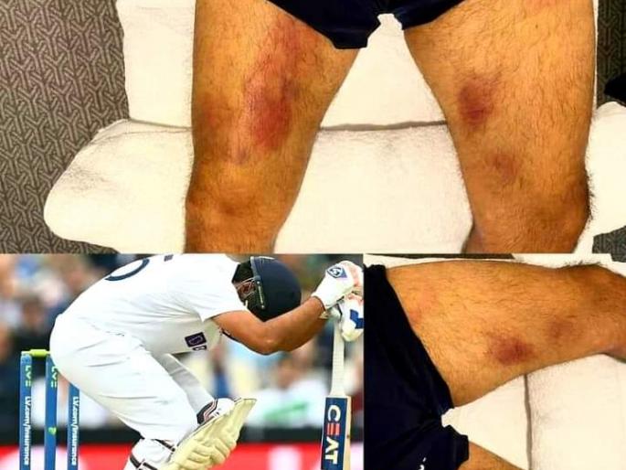 India vs England 5th Test : Mohammed Shami fit to play in Manchester; medical team monitoring Rohit Sharma, Cheteshwar Pujara | India vs England 5th Test : मोहम्मद शमी पाचव्या कसोटीसाठी झालाय फिट; पण रोहित शर्मा, चेतेश्वर पुजारा यांच्या खेळण्यावर संभ्रम