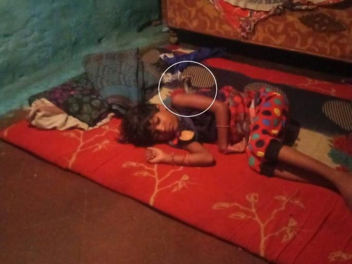 snake bite six-year-old girl at night when sleep; two hours horror in Wardha | सापाचा मध्यरात्री थरार! सहा वर्षांच्या मुलीच्या गळ्यात दोन तास विळखा घालून बसला; अखेर डसला snake bite six-year-old girl at night when sleep; two hours horror in Wardha | सापाचा मध्यरात्री थरार! सहा वर्षांच्या मुलीच्या गळ्यात दोन तास विळखा घालून बसला; अखेर डसला