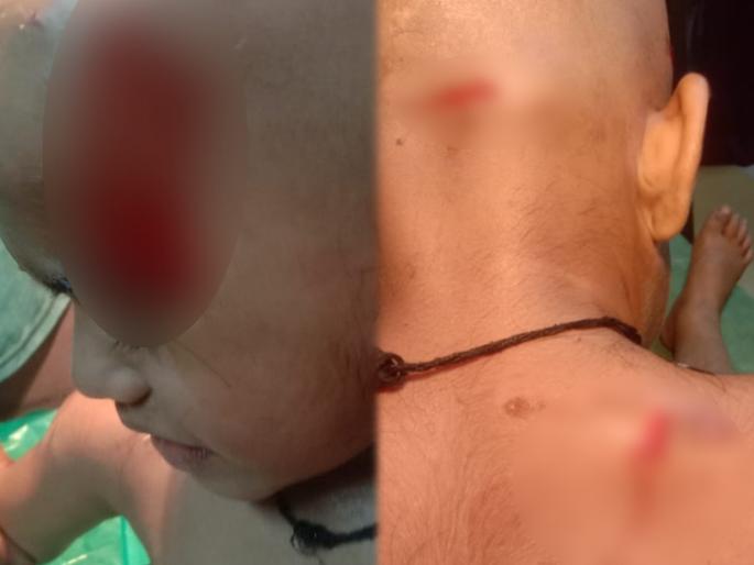 Small kid was bloodied! A four-year-old boy was attacked by a leopard in Arrey | चिमुरड्याला केले रक्तबंबाळ! आरेत चार वर्षांच्या बालकावर बिबट्याचा जीवघेणा हल्ला Small kid was bloodied! A four-year-old boy was attacked by a leopard in Arrey | चिमुरड्याला केले रक्तबंबाळ! आरेत चार वर्षांच्या बालकावर बिबट्याचा जीवघेणा हल्ला