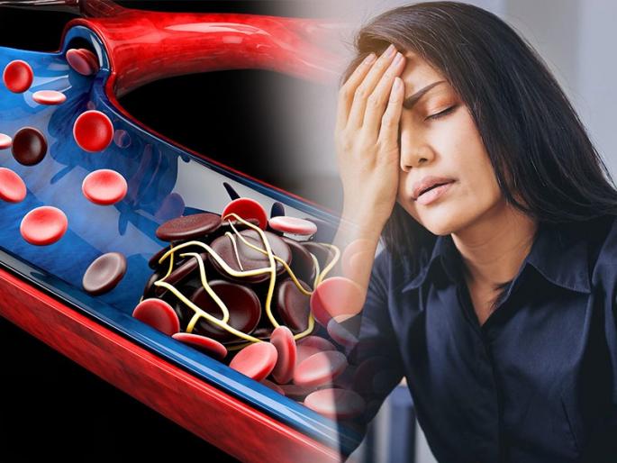 Food for iron deficiency anemia : Hemoglobin deficiency symptoms know how to prevent this deficiency | Food For Anemia : गंभीर आजारांचं कारण ठरतेय हिमोग्लोबिनची कमतरता; अंगातलं रक्त वाढवण्यासाठी रोज खा 'हे' पदार्थ