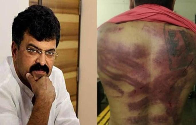 Jitendra Awhad arrested and released in Anant Karamuse assault case | जितेंद्र आव्हाड यांना अनंत करमुसे मारहाण प्रकरणी अटक अन् सुटका Jitendra Awhad arrested and released in Anant Karamuse assault case | जितेंद्र आव्हाड यांना अनंत करमुसे मारहाण प्रकरणी अटक अन् सुटका