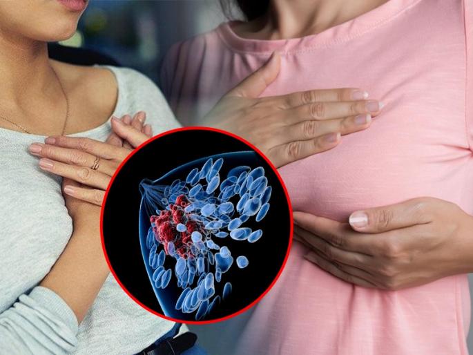 Breast cancer stages symptoms and preventions : What to eat what should not eat for breast cancer | Breast Cancer : कॅन्सरची लक्षणं ठरतात स्तनांमध्ये दिसणारे हे बदल; धोका टाळण्यासाठी काय खायचं, काय नाही? वाचा