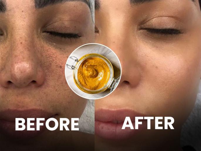 Skin Care Tips Winter Care Tips : 5 ways to use haldi for glowing skin | Skin Care Tips : थंडीत चेहरा खूप कोरडा काळपट, निस्तेज झालाय? चमचाभर हळदीचा 'असा' वापर करून मिळवा ग्लोईंग चेहरा