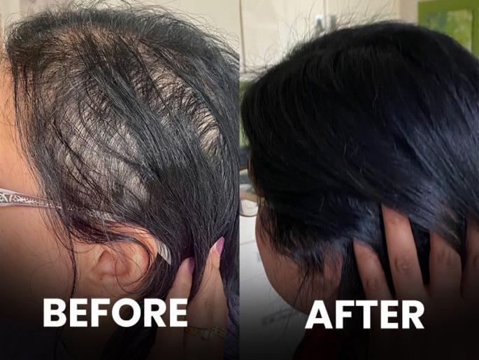 How to stop hair loss : Jawed habib hair care tips to stop baldness | How to stop hair loss : केस गळून गळून खूप पातळ झालेत? दाट, काळ्याभोर, केसांसाठी जावेद हबीबनं सांगितले दोन घरगुती उपाय