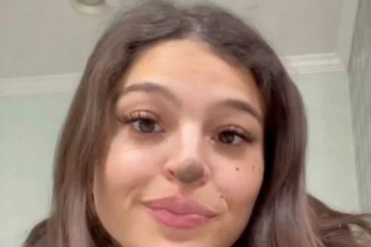 viral woman weird birth mark on nose tip people compare with baby deer | काय सांगता? महिलेच्या नाकावर आहे अजब जन्मखूण; सोशल मीडियावर लोक करताहेत हरणाशी तुलना viral woman weird birth mark on nose tip people compare with baby deer | काय सांगता? महिलेच्या नाकावर आहे अजब जन्मखूण; सोशल मीडियावर लोक करताहेत हरणाशी तुलना