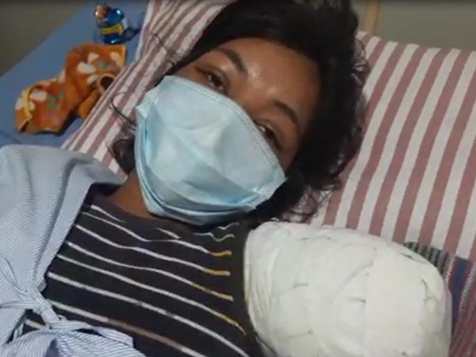 The girl's hand became detached from the body due to the accident; she reached the hospital with hand put into the bag | अपघातामुळे मुलीचा हात झाला शरीरापासून वेगळा; हात बॅगेत घेऊन गाठलं हॉस्पिटल The girl's hand became detached from the body due to the accident; she reached the hospital with hand put into the bag | अपघातामुळे मुलीचा हात झाला शरीरापासून वेगळा; हात बॅगेत घेऊन गाठलं हॉस्पिटल