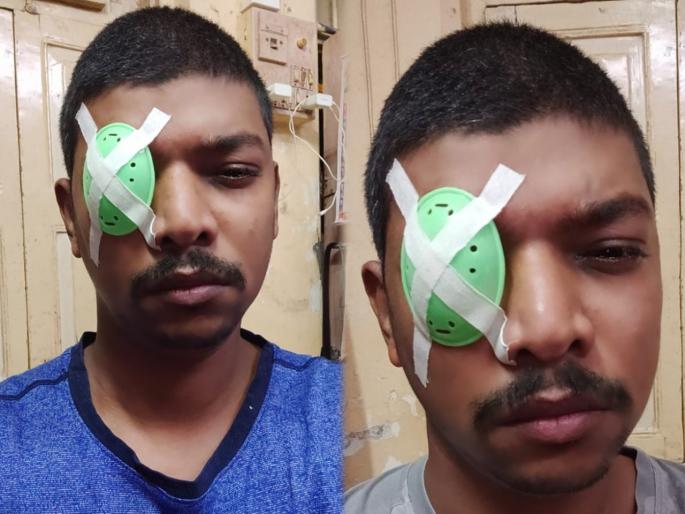 Awful! In Mumbai, a young man was hit in the eye by a policeman with an iron object and a pair of spectacles inserted into eye | भयंकर! मुंबईत पोलिसानं तरुणाच्या डोळ्यावर मारली लोखंडी वस्तू, चष्म्याच्या काचा घुसल्या आरपार Awful! In Mumbai, a young man was hit in the eye by a policeman with an iron object and a pair of spectacles inserted into eye | भयंकर! मुंबईत पोलिसानं तरुणाच्या डोळ्यावर मारली लोखंडी वस्तू, चष्म्याच्या काचा घुसल्या आरपार