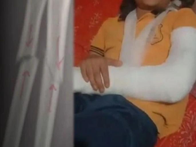 school student 10 year old girl thrashed for not paying school fees teacher broke her hand | संतापजनक! शाळेची फी न भरल्याने 10 वर्षीय मुलीला बेदम मारहाण; शिक्षकाने हातच मोडला अन्... school student 10 year old girl thrashed for not paying school fees teacher broke her hand | संतापजनक! शाळेची फी न भरल्याने 10 वर्षीय मुलीला बेदम मारहाण; शिक्षकाने हातच मोडला अन्...