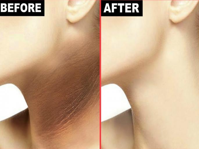 How To Remove Tan From Neck : Beauty expert shahnaz husain says how to get rid of dark neck fast | How To Remove Tan From Neck  : चेहरा गोरा अन् मान काळी पडलीये? शहनाज हुसैनं सांगितला मानेची त्वचा चमकवण्याचा सोपा उपाय