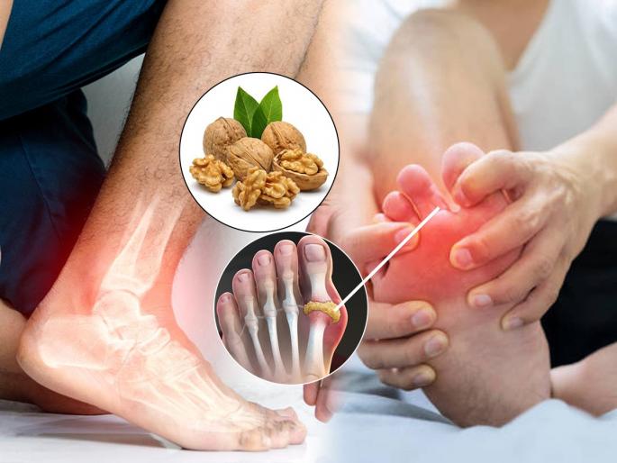 Food For Uric Acid Control : Walnuts dry fruits for uric acid problem control tips joint pain swollen feet pain in leg | वाढलेलं युरीक ॲसिड नियंत्रणात ठेवायचं तर अक्रोड खा, पाहा अक्रोड खाण्याची योग्य पद्धत
