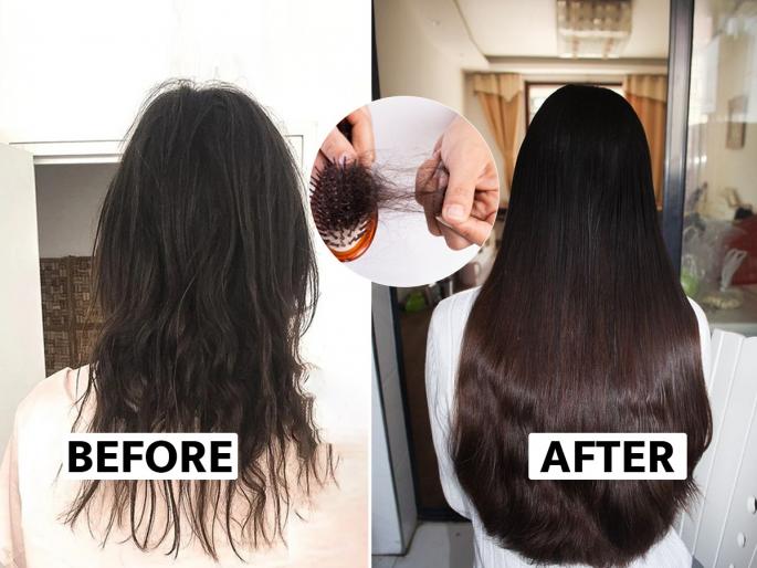 hair fall control solution : Ayurvedic tips to control hair fall by doctor nitika kohli | Hair Fall Control Solution : केस दिवसेंदिवस खूपच गळताहेत? दाट, लांबसडक केस देतील 2 रामबाण उपाय, डॉक्टरांचा सल्ला 