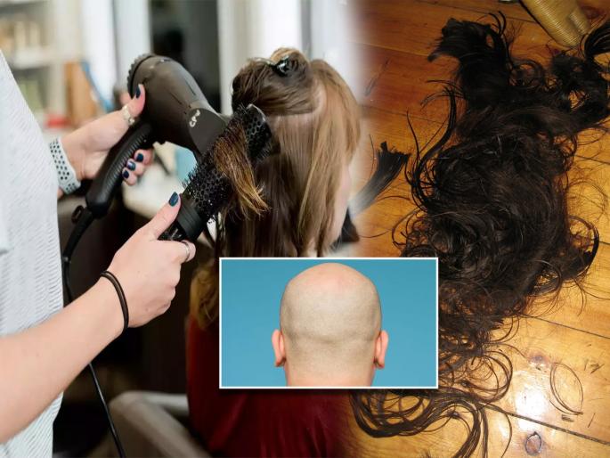 The number of bald people in the city increased; The price of gold came to the hair market | शहरात टक्कल असणाऱ्यांची संख्या वाढली; केसांना बाजारात आला सोन्याचा भाव The number of bald people in the city increased; The price of gold came to the hair market | शहरात टक्कल असणाऱ्यांची संख्या वाढली; केसांना बाजारात आला सोन्याचा भाव