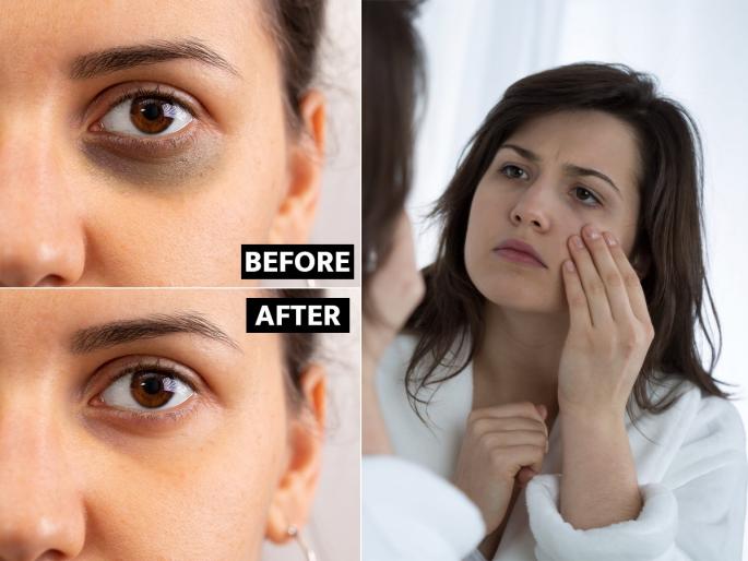 Mudra for dark circles : Which mudra is good for glowing skin and removing dark circles | Mudra for Dark Circles : चेहरा चांगलाय पण डार्क सर्कल्सनी लूक बिघडवलाय? १ उपाय, चेहरा दिसेल ग्लोईंग  