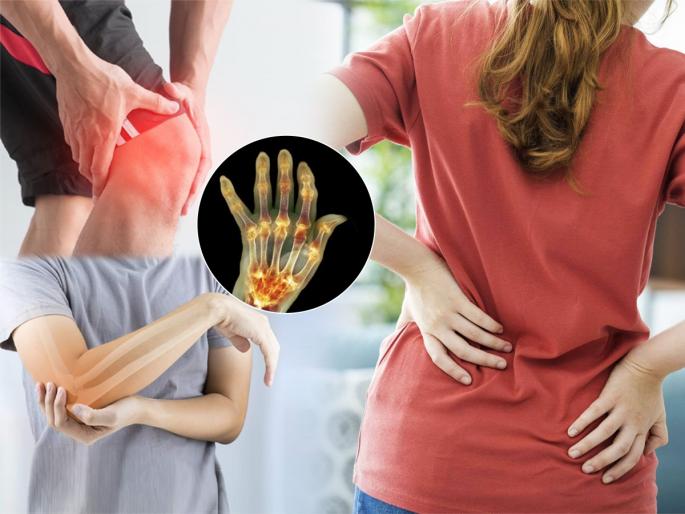 Arthritis Symptoms Risk Factors : Arthritis symptoms risk factors medical treatment myth and home remedies to treat arthritis | कंबर - गुडघे खूपच दुखतात? ५ उपाय, सांधेदुखीपासून मिळेल आराम, डॉक्टारांचा सल्ला वाचा..