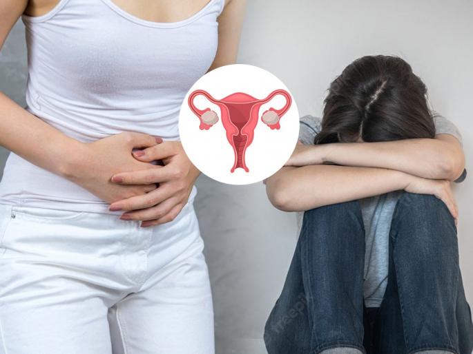 Experts suggests 3 solutions to control the PCOS, How to control PCOS? | PCOS खूपच त्रास? तज्ज्ञ सांगतात ३ नियम, पीसीओएस -मासिक पाळीचा त्रास होईल कमी