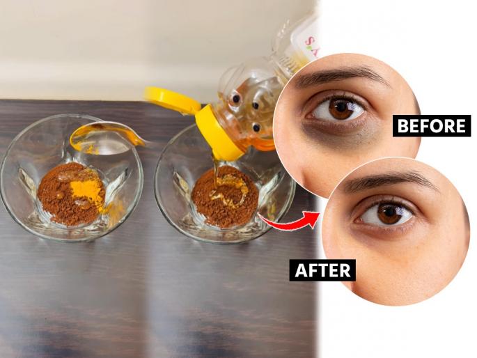 Home made eye mask for dark circles : How to get rid of dark Circles | डार्क सर्कल्समुळे चेहरा डल वाटतोय? कॉफीमध्ये 'हा' पदार्थ मिसळून लावा, चेहरा दिसेल उजळदार