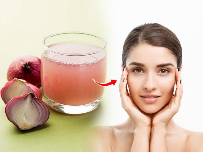 5 benefits of applying onion juice on the face, try this remedy if you want to have beautiful skin in Tuktuk | कांद्याचा रस चेहऱ्याला लावण्याचे ५ फायदे, तुकतुकीत सुंदर त्वचा हवी तर हा उपाय करुन पाहा