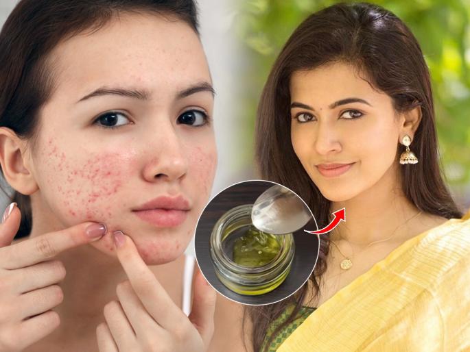 Homemade night cream : Apply this homemade night cream Get a glowing face | पिंपल्समुळे चेहरा डल झालाय? घरी बनवलेली ही नाईट क्रिम लावा; काळे डाग, पिंपल्स होतील दूर