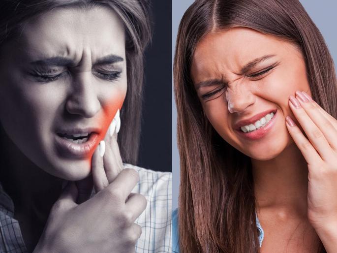 Are your teeth hurting? 5 home remedies, take care of your teeth on time or else.. | दात दुखत आहेत? ५ घरगुती उपाय, दात वेळेवर सांभाळा नाहीतर..
