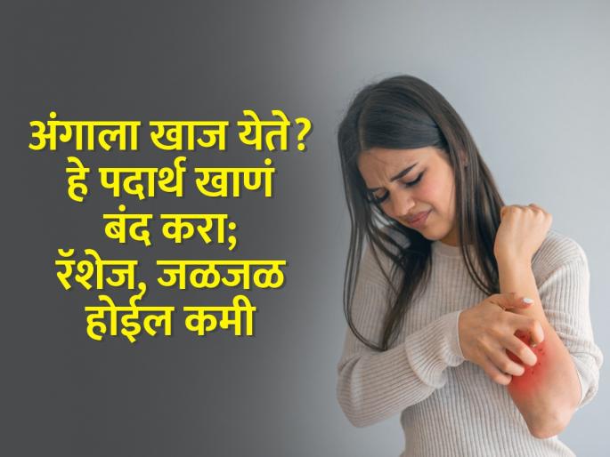 How do you get rid of itchy skin in the winter : Which food is not good for itchy skin | अंगाला खूपच खाज येते? 'हे' पदार्थ खाणं कमी करा; रॅशेज, जळजळ होईल दूर