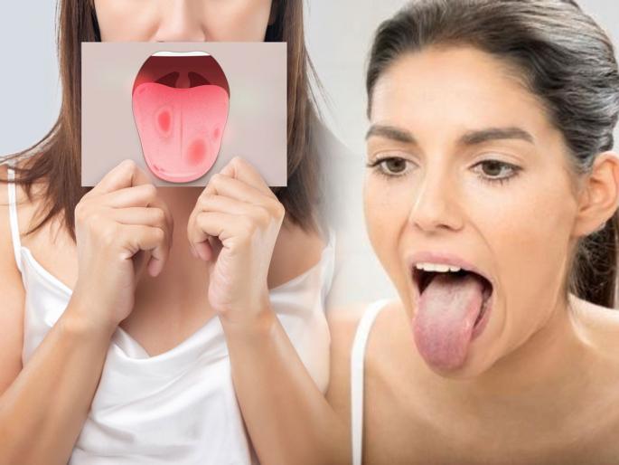 What the Color of Your Tongue Says About Your Health | करा मोठ्ठा आ, पाहा तुमची जीभ कशी दिसते? जिभेचा रंग देतो अनेक शारीरिक समस्यांचे संकेत