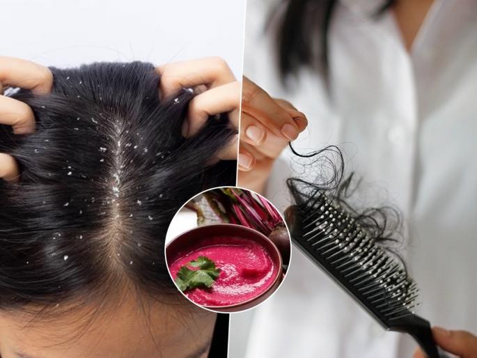 Apply Hair Mask Of Beetroot Peel For These 3 Problems | बीटरूटची साल फेकून देता? फक्त २ साहित्यांचा वापर करून बनवा हेअर मास्क, केसांची समस्या होईल दूर