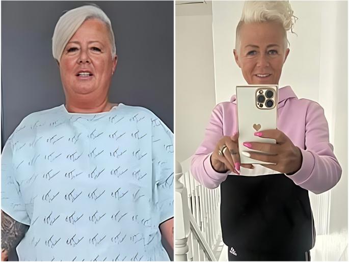 weight loss of mother tracey hutchinson after gastric bypass surgery she looks- like skeleton | वेट लॉसच्या नादात महिलेचा राहिला फक्त सांगाडा; वजन 102 वरून 40 किलो; जाणून घ्या कसं? weight loss of mother tracey hutchinson after gastric bypass surgery she looks- like skeleton | वेट लॉसच्या नादात महिलेचा राहिला फक्त सांगाडा; वजन 102 वरून 40 किलो; जाणून घ्या कसं?