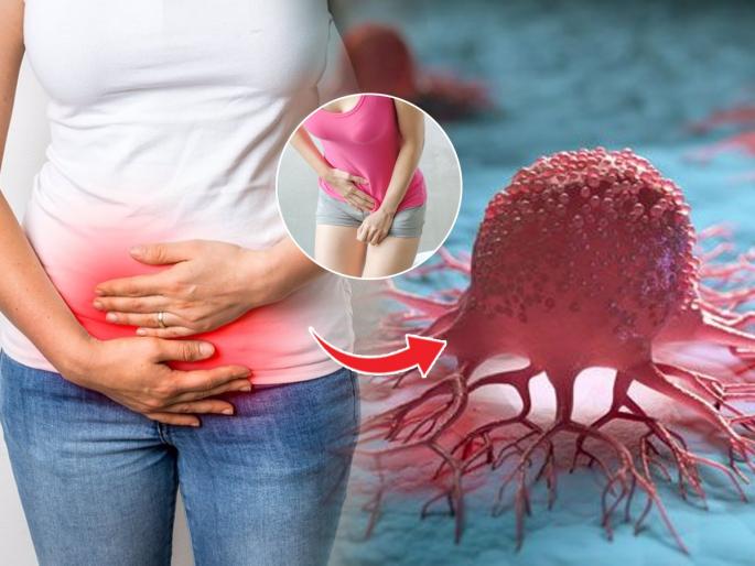 Bladder cancer symptoms should be identified and treated know here | लघवी करताना आग होते, थेंब थेंब लघवी होते? ५ लक्षणे - मुत्राशयाच्या कॅन्सरचा धोका