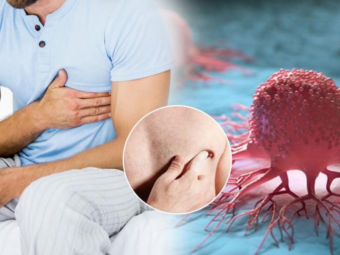 Male breast cancer symptoms which you should not ignore it know male breast cancer signs | पुरुषांनाही होतो ब्रेस्ट कॅन्सर, ५ लक्षणं सांगतात ब्रेस्ट कॅन्सरचा धोका