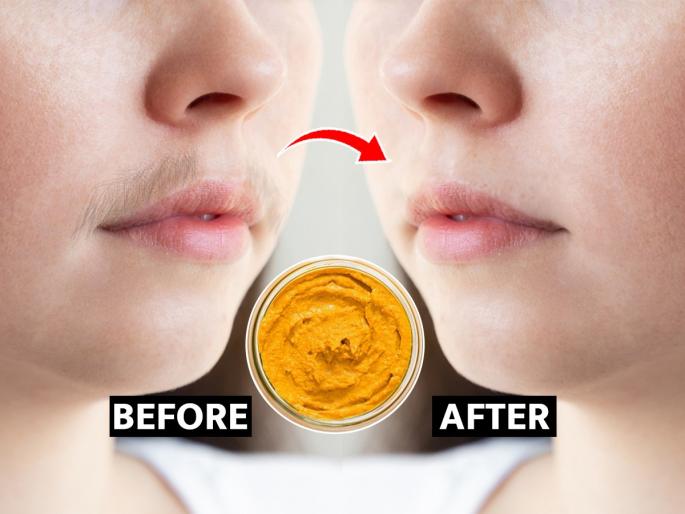 Face pack to remove facial hair naturally at home | ना व्हॅक्सिंग, ना थ्रेडिंग, एक चमचा मैद्याचे करा फेशियल हेअर रिमुव्हल पेस्ट, फेशियल केसांपासून मिळेल सुटका