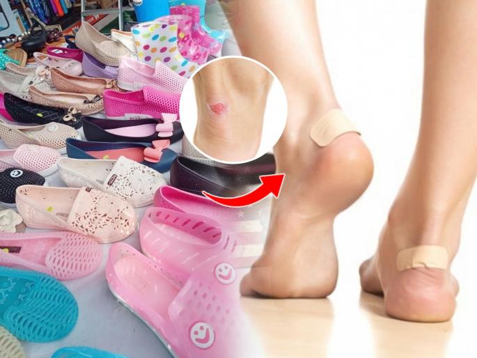 7 Easy Home Remedies And Other Useful Tips To Prevent Painful Shoe Bites In Rainy Season. | पावसाळी नव्या - कोऱ्या चपलांमुळे शु बाईट होते ? ७ सोपे उपाय, शु बाईट पासून मिळेल मुक्ती...
