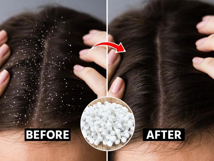 3 Benefits & Best Ways To Use Camphor For Healthy Hair | कापूर-कडूनिंब- लिंबू आणि दही, केसांत कोंड्याचे थर असतील तर करा ३ उपाय