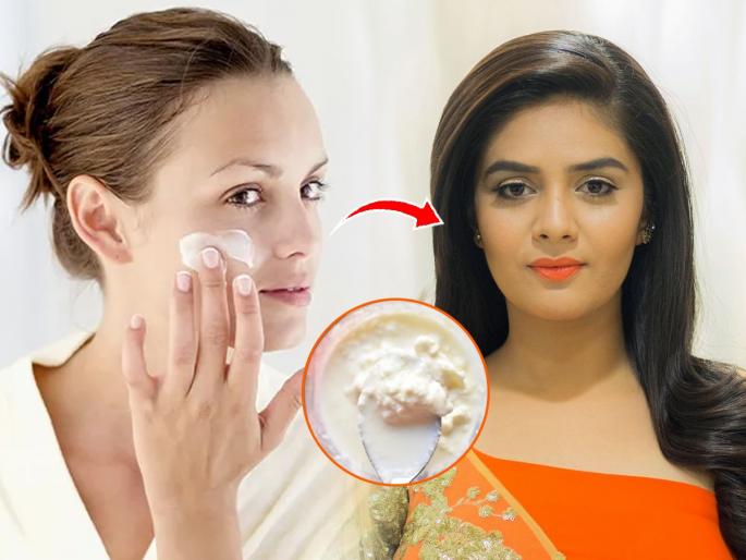 Benefits of Milk Cream For Skin And How to Use For A Glowing Face | चेहऱ्यावर चमचाभर दुधाची साय लावा; दिसाल तरूण-सुंदर, मिळतील फायदेच फायदे