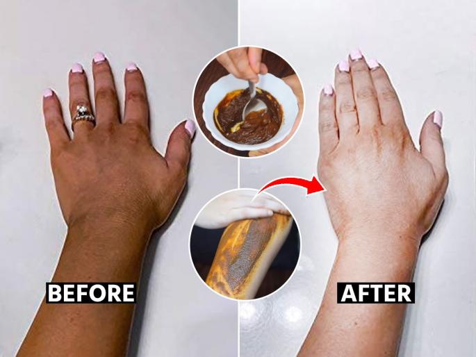 Best solution for tanning in just 10 rupees, How to get tan free, fresh skin? Home remedies for tanning | फक्त १० रुपयात टॅन झालेली, काळवंडलेली त्वचा होईल स्वच्छ उजळ.. करून बघा १ सोपा उपाय