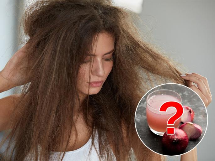 Shocking Side Effects Of Onion Juice On Hair | केस वाढावेत म्हणून केसांना कांद्याचा रस चोपडताय? - ते धोक्याचं!कांद्याचा रस कुणी लावावा आणि कुणी..