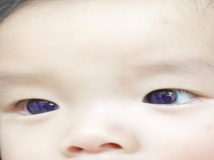 covid 19 treatment side effect 6 months baby eyes convert in blue colour in thailand | Corona Virus : कोरोना उपचारानंतर मुलाच्या डोळ्यांचा अचानक बदलला रंग, झाले निळे; नेमकं काय घडलं? covid 19 treatment side effect 6 months baby eyes convert in blue colour in thailand | Corona Virus : कोरोना उपचारानंतर मुलाच्या डोळ्यांचा अचानक बदलला रंग, झाले निळे; नेमकं काय घडलं?