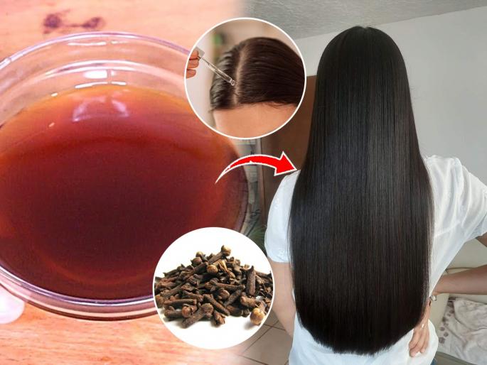 Clove Water For Hair: Benefits And Ways To Use It | केसांना लवंगांचे पाणी लावण्याचे ३ फायदे, केसांना येईल चमक-केस गळणेही थांबेल लवकर