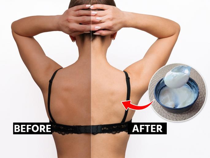 Home remedies for tanning on back neck, How to clean back neck? Body polishing effect in just 10 rupees at home  | मान- पाठ खूपच काळवंडली? टॅनिंग कमी करण्यासाठी स्वयंपाक घरातले फक्त ३ पदार्थ वापरा, त्वचा छान उजळेल 