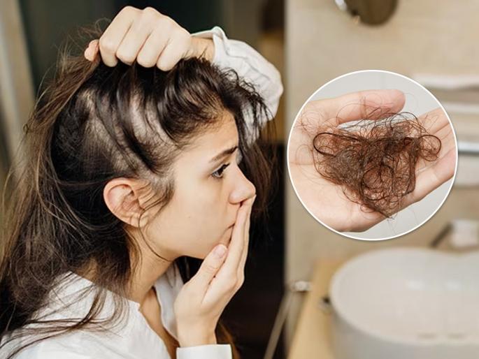 How to Use Coconut Oil for Hair Growth and Thickness : How to Apply Coconut Oil to Hair | डोक्यावर हात फिरवताच केसांचा झुपका हाती येतो? नारळ तेल या पद्धतीने लावा-केस गळणं थांबेल