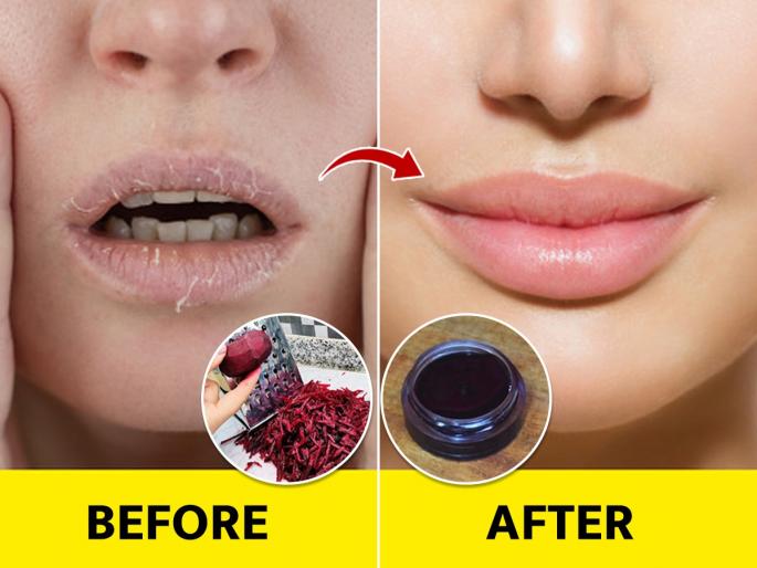 Beet root lip balm for dry lips, How to get rid of blackness of lips, How to get pink lips naturally? Home remedies for pink lips | ओठांचा काळपटपणा जाईल आणि ओठ होतील गुलाबी, करा १ सोपा उपाय- विकतचे लिपबाम विसराल