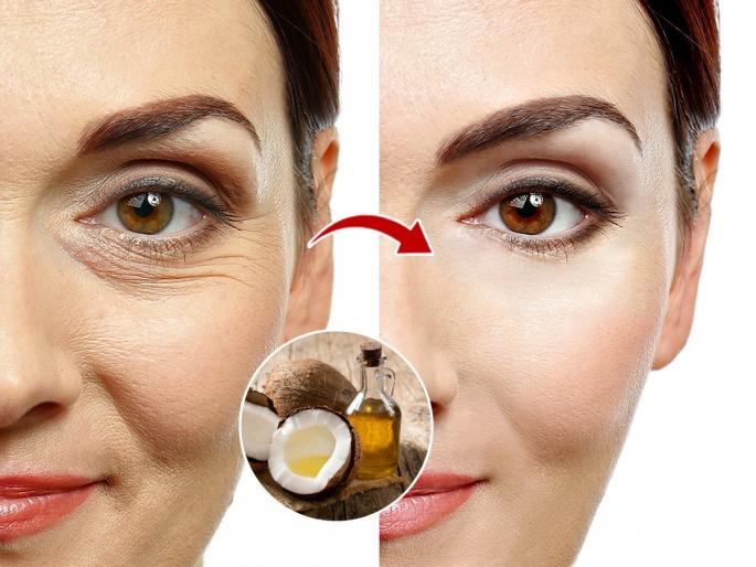 2 Ways Coconut Oil Can Help You Get Rid Of Wrinkles | कमी वयात चेहऱ्यावर फाईन लाईन्स, सुरकुत्या दिसू लागल्या? खोबरेल तेलाचे २ उपाय, रात्री लावा-सकाळी चमक पाहा