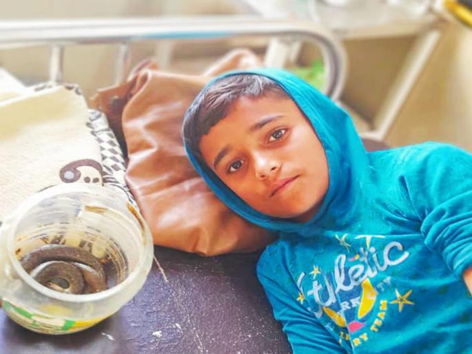 'Doctor, this snake has bitten'; Uncle took nephew and snake straight to the hospital | 'डॉक्टर, हा साप चावला'; पुतण्या अन् सापाला घेऊन काकाची उपचारासाठी भटकंती 'Doctor, this snake has bitten'; Uncle took nephew and snake straight to the hospital | 'डॉक्टर, हा साप चावला'; पुतण्या अन् सापाला घेऊन काकाची उपचारासाठी भटकंती