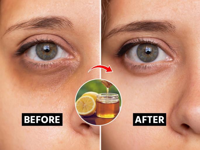 Natural, effective remedy of honey to lighten dark circles | जाता जात नाही हट्टी डार्क सर्कल? मधात मिसळा फक्त २ गोष्टी, काळी वर्तुळे गायब-डोळे दिसतील टपोरे
