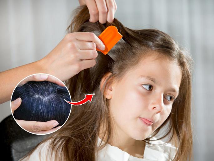 4 Superfoods To Avoid Premature Greying in Kids | लहान वयातच केसांची मुळे पांढरी झाली? केस गळतात? मुलांना खायला द्या ४ पदार्थ-केस होतील दाट
