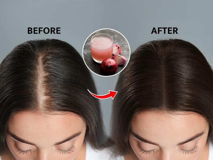 How Can Onion Juice Improve Your Hair? | कंगवा फिरवताच फरशीवर केसच केस? 'या' भाजीच्या रसाचा करा वापर; पांढरे केसही होतील गायब
