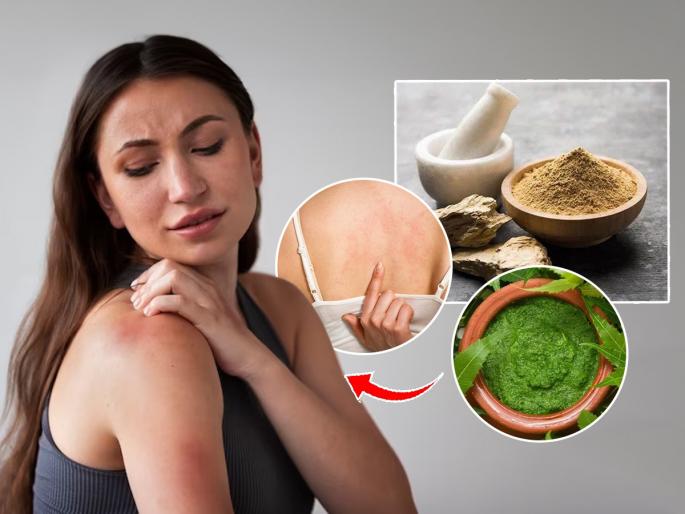 home remedies for rash due to sweating in summer, how to get rid of ghamole in marathi | घामोळे झाले? खाज येते? ३ उपाय- घामोळ्यांनी त्रस्त असाल तर मिळेल त्वरित आराम