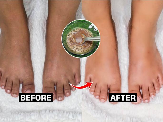 How To Give a Pedicure To Our Feet At Home? by using Shampoo | ना पेस्ट - ना खर्च, १ रुपयाच्या शाम्पूने करा पेडीक्युअर, पायाचा काळेपणा होईल दूर; दिसतील स्वच्छ